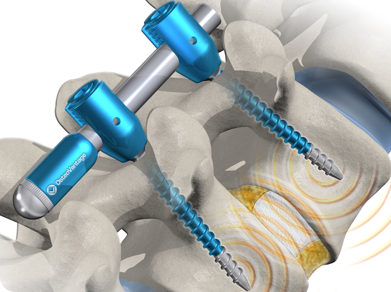 medical illustration